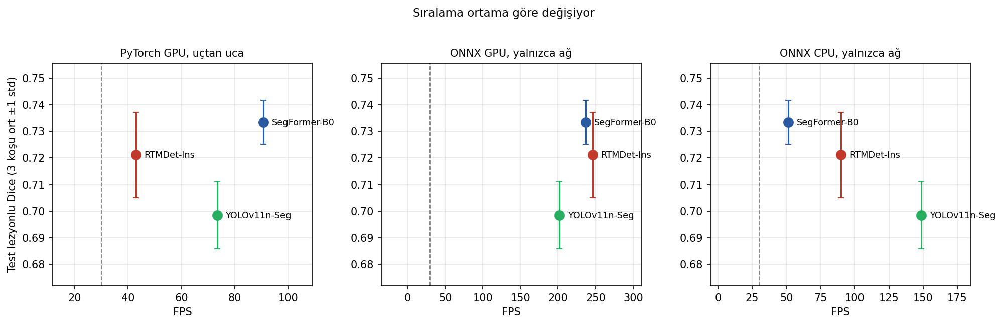 Ultrason segmentasyonunda üç mimarinin kalite ve hız karşılaştırması